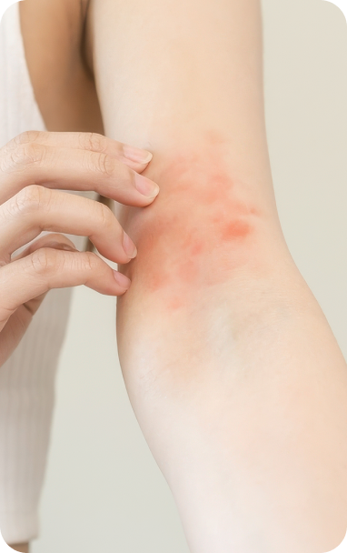 bibiotic derma helps