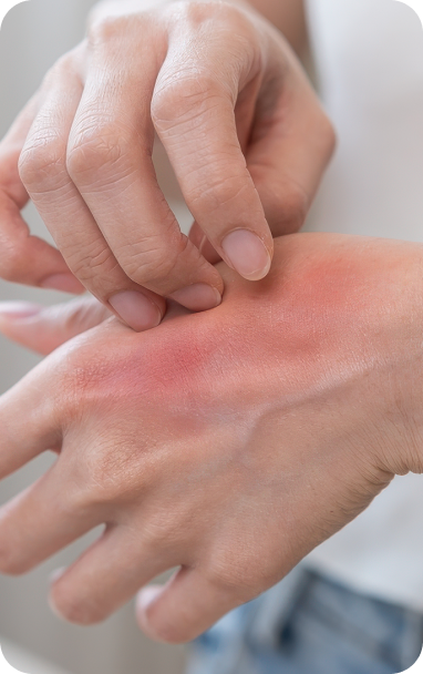 bibiotic derma helps