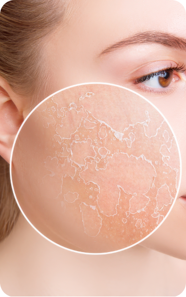 bibiotic derma helps